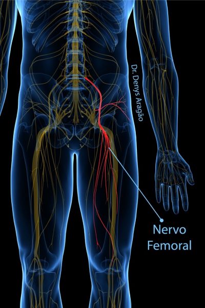 Falseio Nervo Femoral | Dr. Denys Aragão