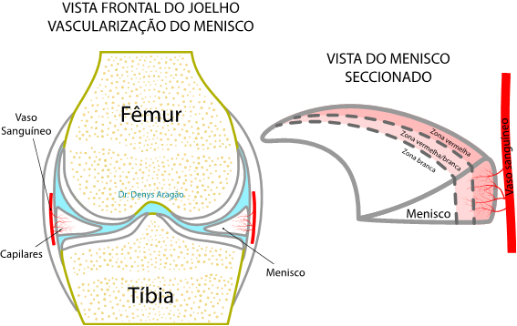 Vista Frontal do Joelho - Vascularização do Menisco | Dr. Denys Aragão